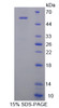 Rat Recombinant Renal Tumor Antigen (RAGE)