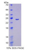 Human Recombinant Peroxisome Proliferator Activated Receptor Gamma Coactivator 1 Alpha (PPARgC1a)