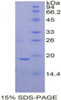 Rat Recombinant Periostin (POSTN)