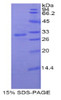 Rat Recombinant Paraneoplastic Antigen MA2 (PNMA2)
