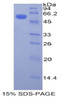 Human Recombinant Plastin 3 (PLS3)