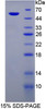 Mouse Recombinant Phosphoglycolate Phosphatase (PGP)