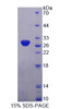 Human Recombinant Pyruvate Dehydrogenase Complex Component X (PDHX)