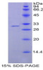 Human Recombinant Nicotinamide-N-Methyltransferase (NNMT)