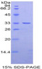 Rat Recombinant Nexilin (NEXN)