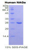 Human Recombinant N-Acetylgalactosaminidase Alpha (NAGa)