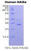 Human Recombinant N-Acetylgalactosaminidase Alpha (NAGa)