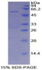 Mouse Recombinant Mesothelin (MSLN)