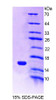 Mouse Recombinant Melanoma Inhibitory Activity Protein 1 (MIA1)