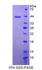 Rat Recombinant Melanoma Inhibitory Activity Protein 1 (MIA1)