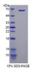 Human Recombinant Malate Dehydrogenase 1 (MDH1)