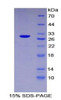 Human Recombinant Lymphocyte Adaptor Protein (Lnk)