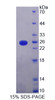 Human Recombinant V-Ki-Ras2 Kirsten Rat Sarcoma Viral Oncogene Homolog (KRAS)