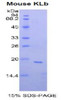 Mouse Recombinant Klotho Beta (KLb)