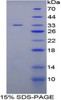 Human Recombinant Inter Alpha-Globulin Inhibitor H4 (ITIH4)