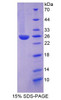 Human Recombinant Inter Alpha-Globulin Inhibitor H3 (ITIH3)