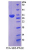 Human Recombinant Inter Alpha-Globulin Inhibitor H2 (ITIH2)