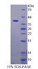 Human Recombinant Inter Alpha-Globulin Inhibitor H1 (ITIH1)