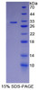 Human Recombinant Iron ResPonsive Element Binding Protein 2 (IREB2)