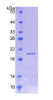 Mouse Recombinant Interleukin 18 Binding Protein (IL18BP)