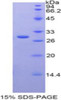 Rat Recombinant Galactose-3-O-Sulfotransferase 1 (GAL3ST1)