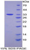 Human Recombinant FOS Like Antigen 1 (FOSL1)