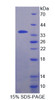 Human Recombinant Fidgetin (FIGN)