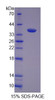 Mouse Recombinant F-Box And Leucine Rich Repeat Protein 3 (FBXL3)