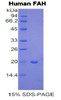 Human Recombinant Fumarylacetoacetate Hydrolase (FAH)