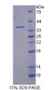 Human Recombinant Dual Specificity Tyrosine Phosphorylation Regulated Kinase 1A (DYRK1A)