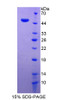 Human Recombinant Destrin (DSTN)