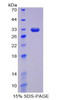 Human Recombinant DNA Methyltransferase 1 (DNMT1)