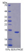 Human Recombinant GABA-A Receptor Associated Protein Like Protein 2 (GABARAPL2)