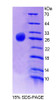 Human Recombinant Casein Alpha (CSN1)