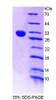 Mouse Recombinant Chitinase 1 (CHIT1)