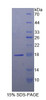 Human Recombinant Lecithin Cholesterol Acyltransferase (LCAT)