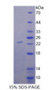 Human Recombinant Lecithin Cholesterol Acyltransferase (LCAT)