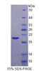 Human Recombinant Alpha-Methylacyl Coenzyme A Racemase (aMACR)