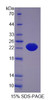 Human Recombinant Interleukin 21 Receptor (IL21R)