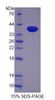 Human Recombinant LIM And SH3 Protein 1 (LASP1)