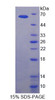 Human Recombinant Inhibitor Of Kappa-Light Polypeptide Gene Enhancer In B-Cells Kinase Beta (IkBKb)