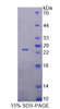 Human Recombinant Achaete Scute Complex Like Protein 1 (ASCL1)