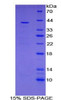 Human Recombinant V-Set Domain Containing T-Cell Activation Inhibitor 1 (VTCN1)