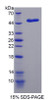 Human Recombinant Non Metastatic Cells 5, Protein NM23A Expressed In (NME5)