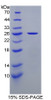 Mouse Recombinant Non Metastatic Cells 5, Protein NM23A Expressed In (NME5)