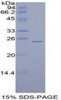 Human Recombinant Sprouty Homolog 1 (SPRY1)