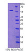 Human Recombinant Sprouty Related, EVH1 Domain Containing Protein 2 (SPRED2)