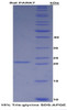 Rat Recombinant Parkinson Disease Protein 7 (PARK7)