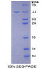 Human Recombinant CD2 Associated Protein (CD2AP)