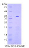 Mouse Recombinant Checkpoint Homolog (CHEK1)